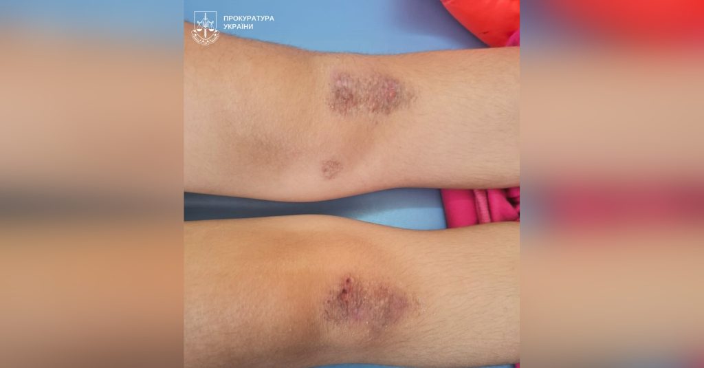Дві доби стояли на колінах без їжі: на Полтавщині опікунку підозрюють у катуванні двох сестер